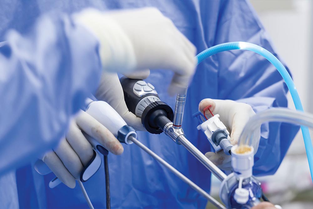 Laparoscopic & Endoscopic Surgery