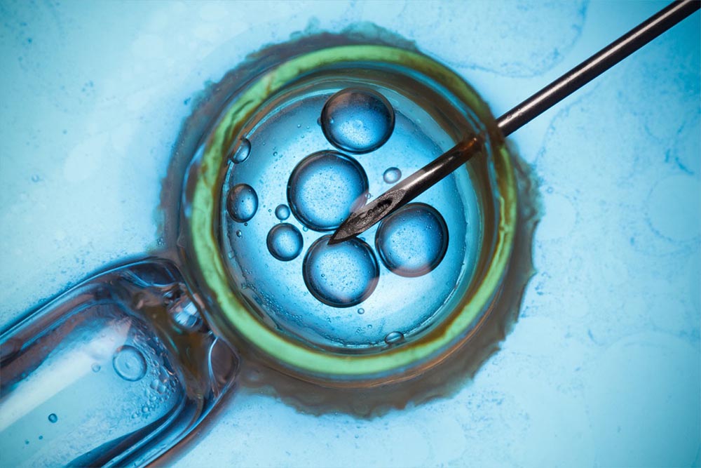 Subfertility - IVF Assisted Reproduction